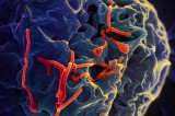 Se confirma primer caso de Ébola en Estados Unidos